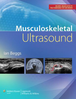 Kniha Musculoskeletal Ultrasound Ian Beggs