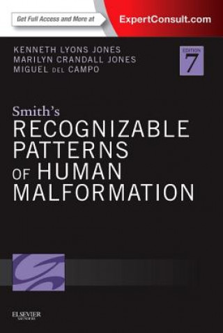Carte Smith's Recognizable Patterns of Human Malformation Kenneth Lyons Jones