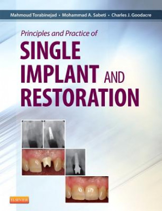 Carte Principles and Practice of Single Implant and Restoration Mahmoud Torabinejad