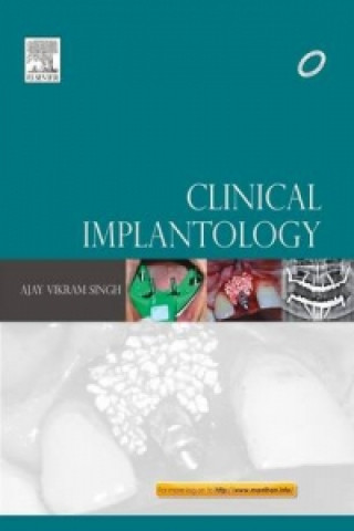 Kniha Clinical Implantology Ajay Vikram Singh
