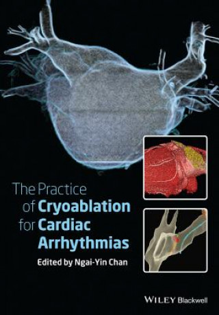 Книга Practice of Catheter Cryoablation for Cardiac Arrhythmias Ngai Yin Chan