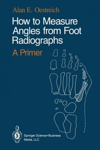 Buch How to Measure Angles from Foot Radiographs Alan E. Oestreich