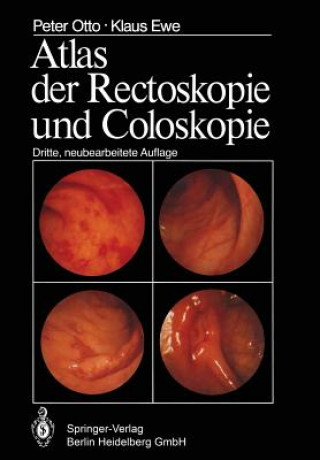 Kniha Atlas Der Rectoskopie Und Coloskopie P. Otto