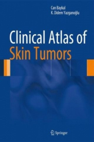 Kniha Clinical Atlas of Skin Tumors Can Baykal