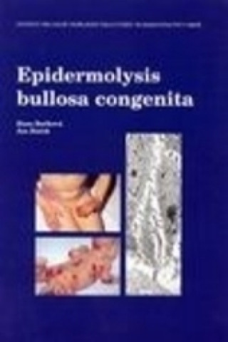 Kniha Epidermolysis bullosa congenita Hana Bučková