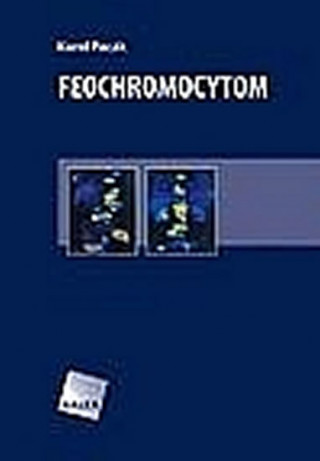 Kniha Feochromocytom Karel Pacák