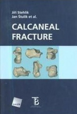 Книга Calcaneal Fracture Jiří Stehlík