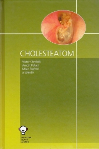 Kniha Cholesteatom Viktor Chrobok
