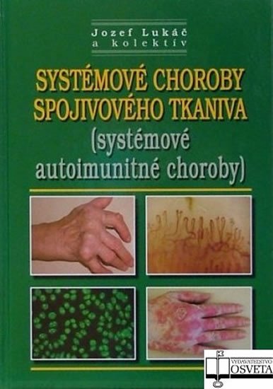 Livre Systémové choroby spojivového tkaniva Jozef Lukáč a kolektív autorov