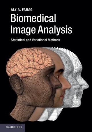 Kniha Biomedical Image Analysis Aly A. Farag