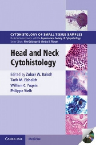 Книга Head and Neck Cytohistology with DVD-ROM Zubair W. Baloch
