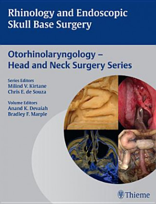 Kniha Rhinology and Endoscopic Skull Base Surgery Anand K. Devaiah