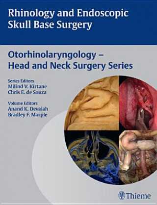 Livre Rhinology and Endoscopic Skull Base Surgery Anand K. Devaiah