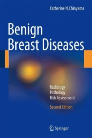 Knjiga Benign Breast Diseases Catherine N. Chinyama