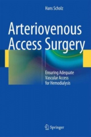Book Arteriovenous Access Surgery Hans Scholz