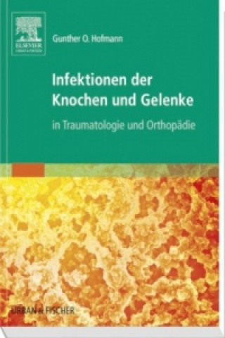 Buch Infektionen der Knochen und Gelenke Gunther O Hofmann