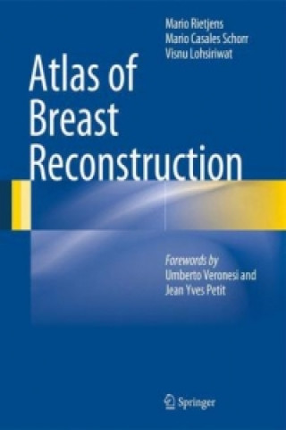 Knjiga Atlas of Breast Reconstruction Rietjens
