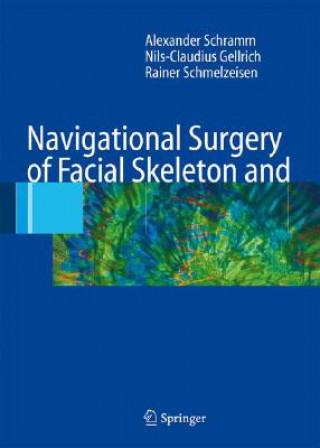 Kniha Navigational Surgery of the Facial Skeleton and Skull Base Alexander Schramm