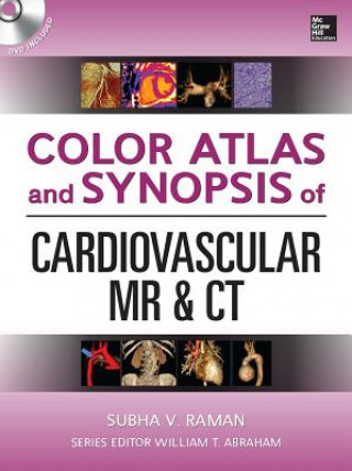 Carte Color Atlas and Synopsis of Cardiovascular MR and CT (SET 2) Subha V Raman