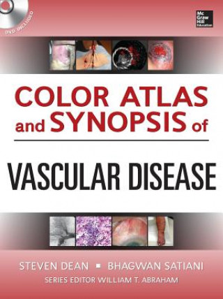 Carte Color Atlas and Synopsis of Vascular Disease Steven Dean