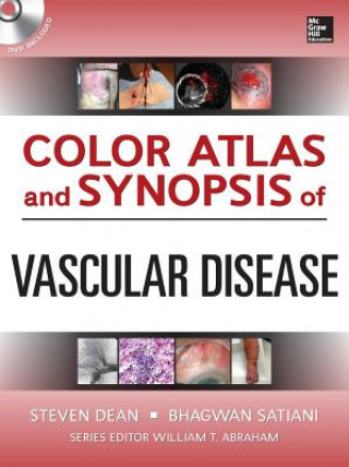 Książka Color Atlas and Synopsis of Vascular Disease Steven Dean