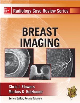 Knjiga Radiology Case Review Series: Breast Imaging Chris Flowers