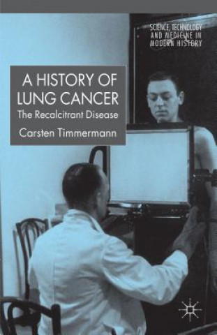Könyv History of Lung Cancer Carsten Timmermann