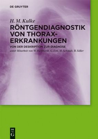 Kniha Roentgendiagnostik von Thoraxerkrankungen H. M. Kulke