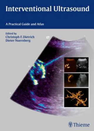 Knjiga Interventional Ultrasound Christoph Frank Dietrich