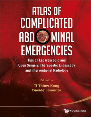 Knjiga Atlas Of Complicated Abdominal Emergencies: Tips On Laparoscopic And Open Surgery, Therapeutic Endoscopy And Interventional Radiology (With Dvd-rom) Ti Thiow Kong