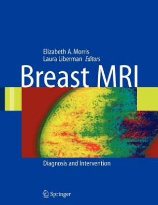Könyv Breast MRI Elizabeth A. Morris