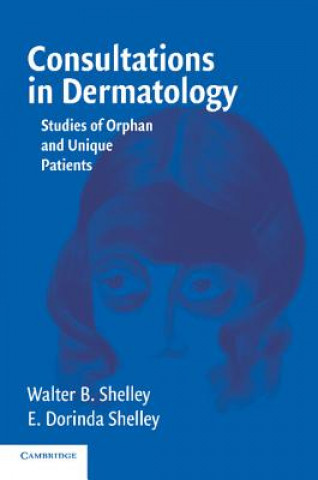 Livre Consultations in Dermatology Walter B. (Medical University of Ohio) Shelley