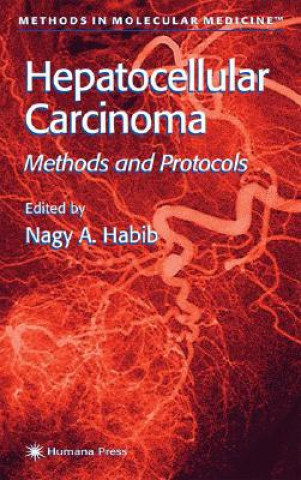 Carte Hepatocellular Carcinoma Nagy A. Habib