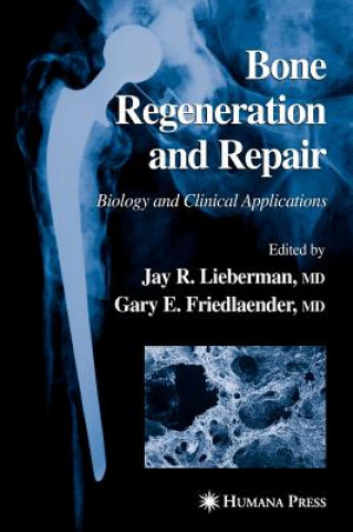 Book Bone Regeneration and Repair Jay R. Lieberman
