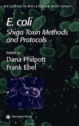 Könyv E. coli Dana Philpott