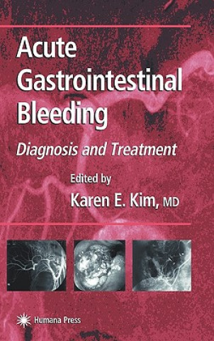 Kniha Acute Gastrointestinal Bleeding Karen E. Kim