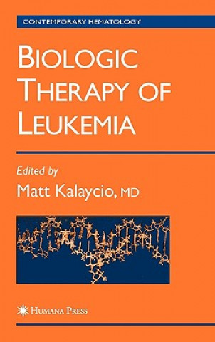 Carte Biologic Therapy of Leukemia Matt Kalaycio
