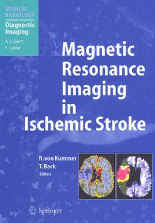 Carte Magnetic Resonance Imaging in Ischemic Stroke Rüdiger von Kummer