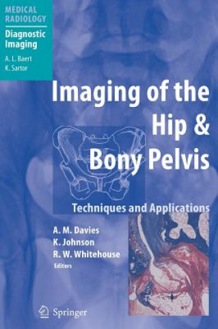 Książka Imaging of the Hip & Bony Pelvis A. M. Davies