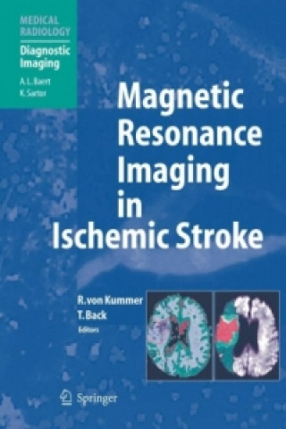 Kniha Magnetic Resonance Imaging in Ischemic Stroke Rüdiger von Kummer