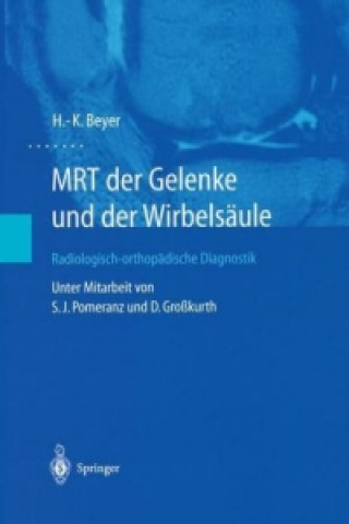 Kniha MRT der Gelenke und der Wirbelsaule H.-K. Beyer