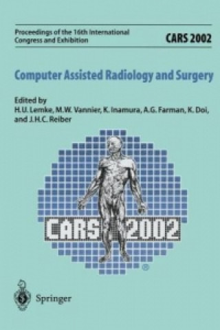 Könyv CARS 2002 Computer Assisted Radiology and Surgery H.U. Lemke