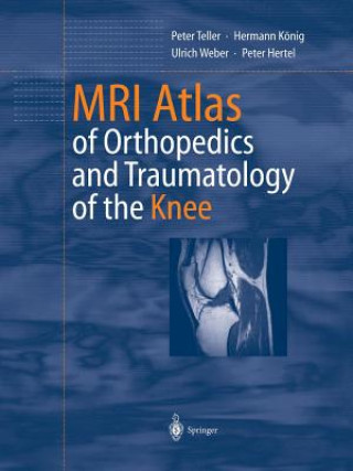 Carte MRI Atlas of Orthopedics and Traumatology of the Knee Peter Teller