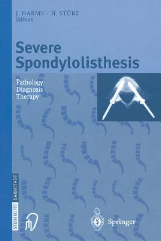 Książka Severe Spondylolisthesis J. Harms