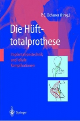 Könyv Die Hufttotalprothese Peter E. Ochsner