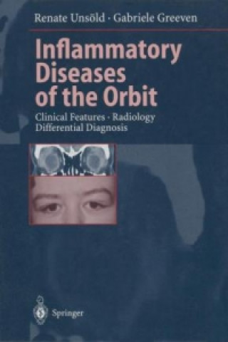 Könyv Inflammatory Diseases of the Orbit Renate Unsöld