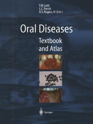 Kniha Oral Diseases Torello M. Lotti