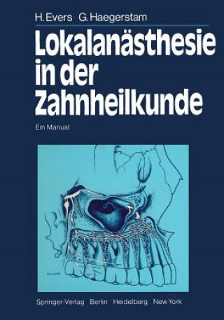 Carte Lokalanasthesie in Der Zahnheilkunde H. Evers