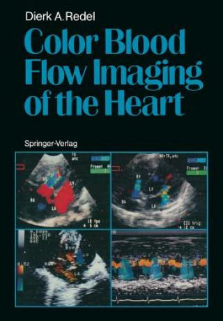 Kniha Color Blood Flow Imaging of the Heart Dierk A. Redel