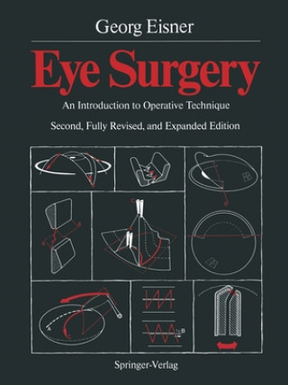 Könyv Eye Surgery Georg Eisner